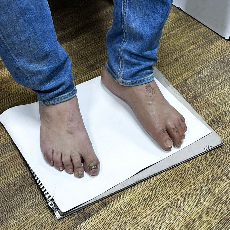 مقارنة القدم الصناعية